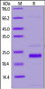 SARS-CoV-2 (COVID-19) NSP1 recombinant protein on SDS-PAGE under reducing (R) condition. The gel was stained overnight with Coomassie Blue. The purity of the protein is greater than 90%.