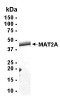SDS PAGE: Analysis of MAT2A Recombinant Protein. 4-20% SDS gradient gel. Coomassie blue staining.