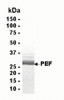 SDS PAGE: Analysis of PEF Recombinant Protein. 4-20% SDS gradient gel. Coomassie blue staining.