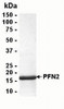 SDS PAGE: Analysis of PFN2 Recombinant Protein. 4-20% SDS gradient gel. Coomassie blue staining.