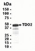 SDS PAGE: Analysis of TDO2 Recombinant Protein. 4-20% SDS gradient gel. Coomassie blue staining.