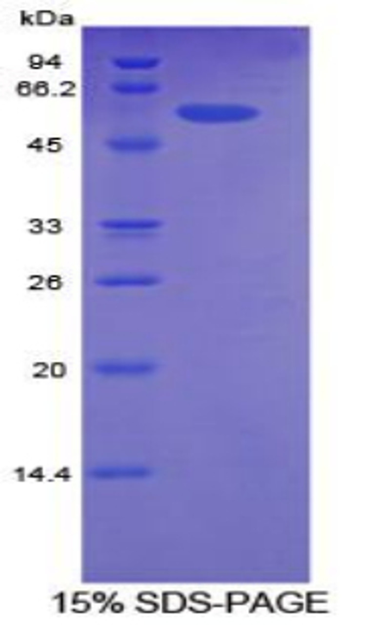 Human Recombinant Activated Leukocyte Cell Adhesion Molecule (ALCAM)