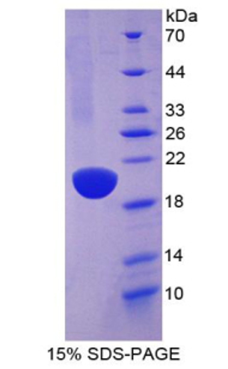 Human Recombinant Angiotensin I Converting Enzyme (ACE)