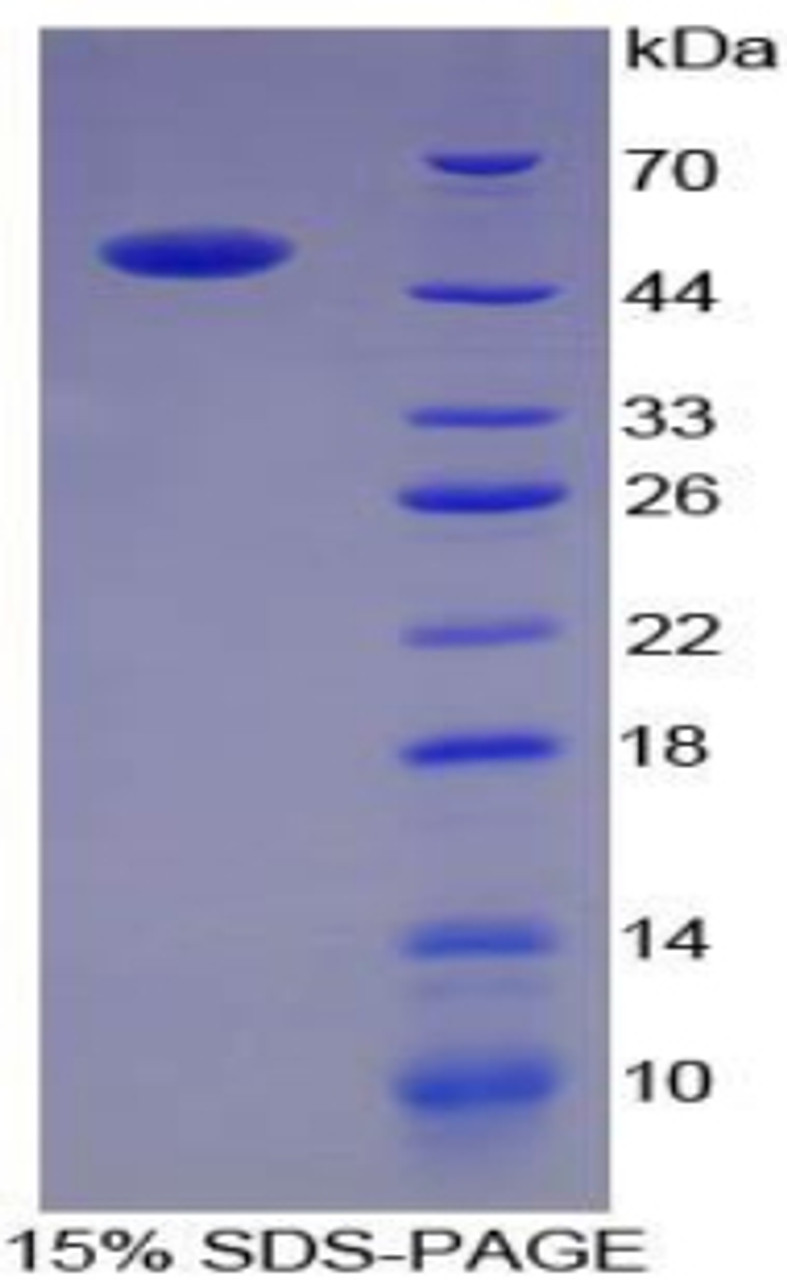 Pig Recombinant Angiotensin I Converting Enzyme (ACE)