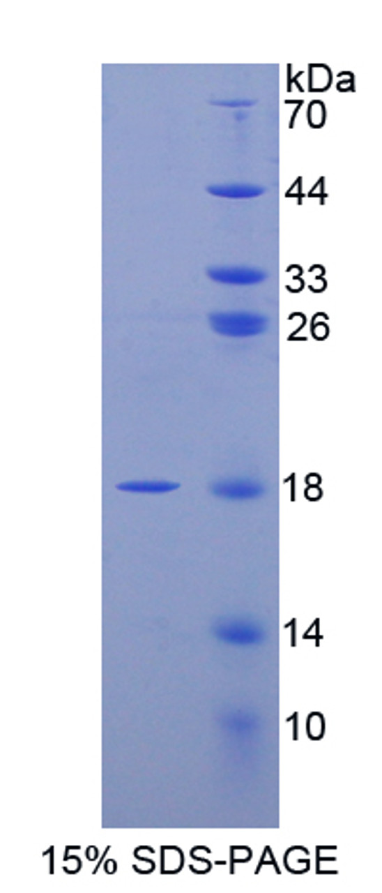 Human Recombinant Angiogenin (ANG)