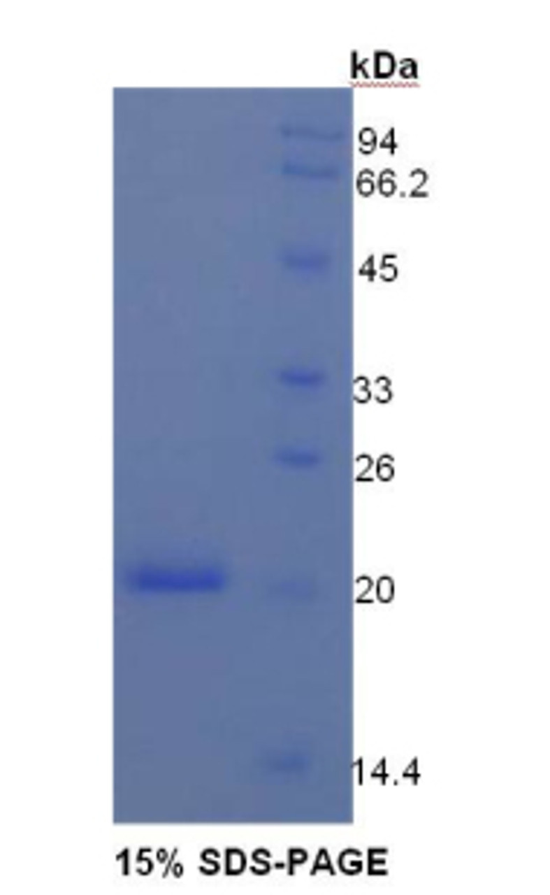 Mouse Recombinant Angiopoietin 1 (ANGPT1)