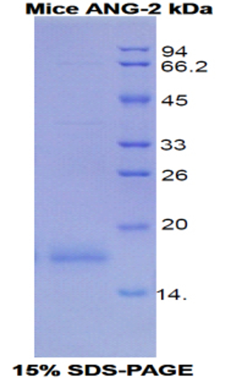 Mouse Recombinant Angiopoietin 2 (ANGPT2)