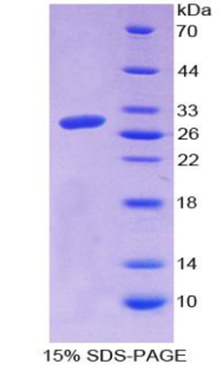 Cattle Recombinant Connective Tissue Growth Factor (CTGF)