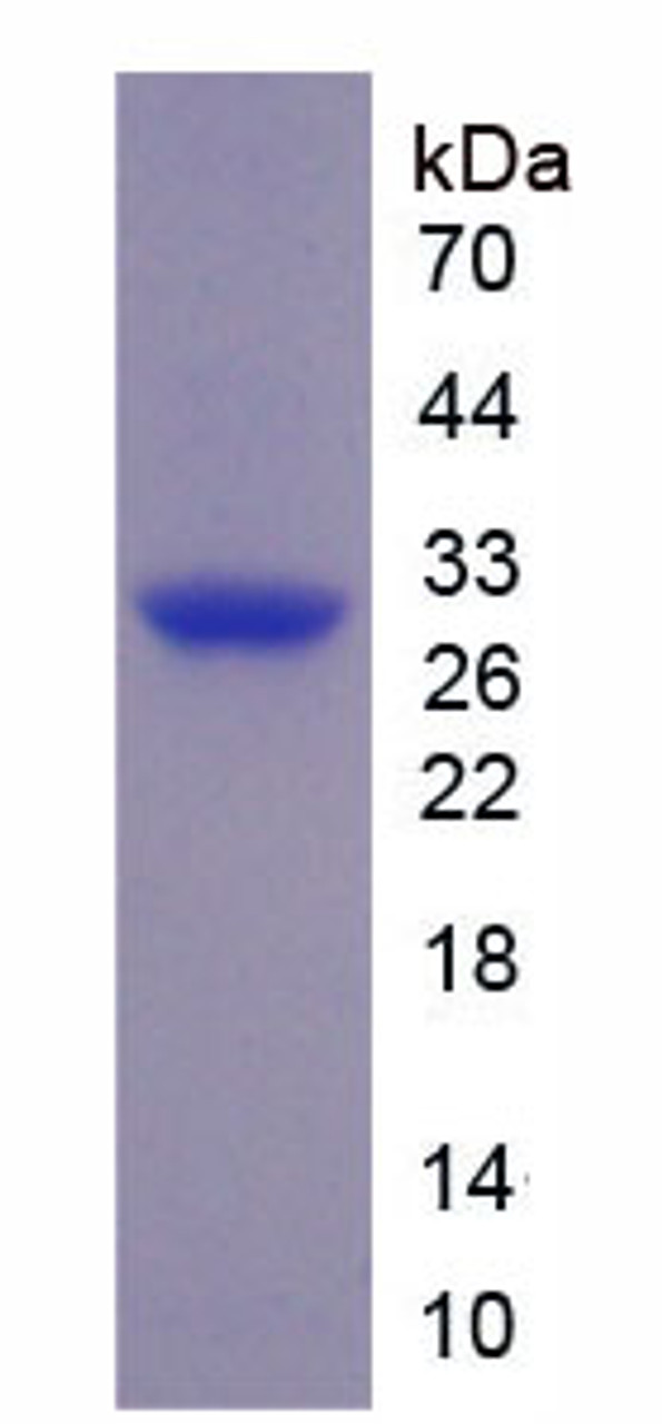 Pig Recombinant Connective Tissue Growth Factor (CTGF)