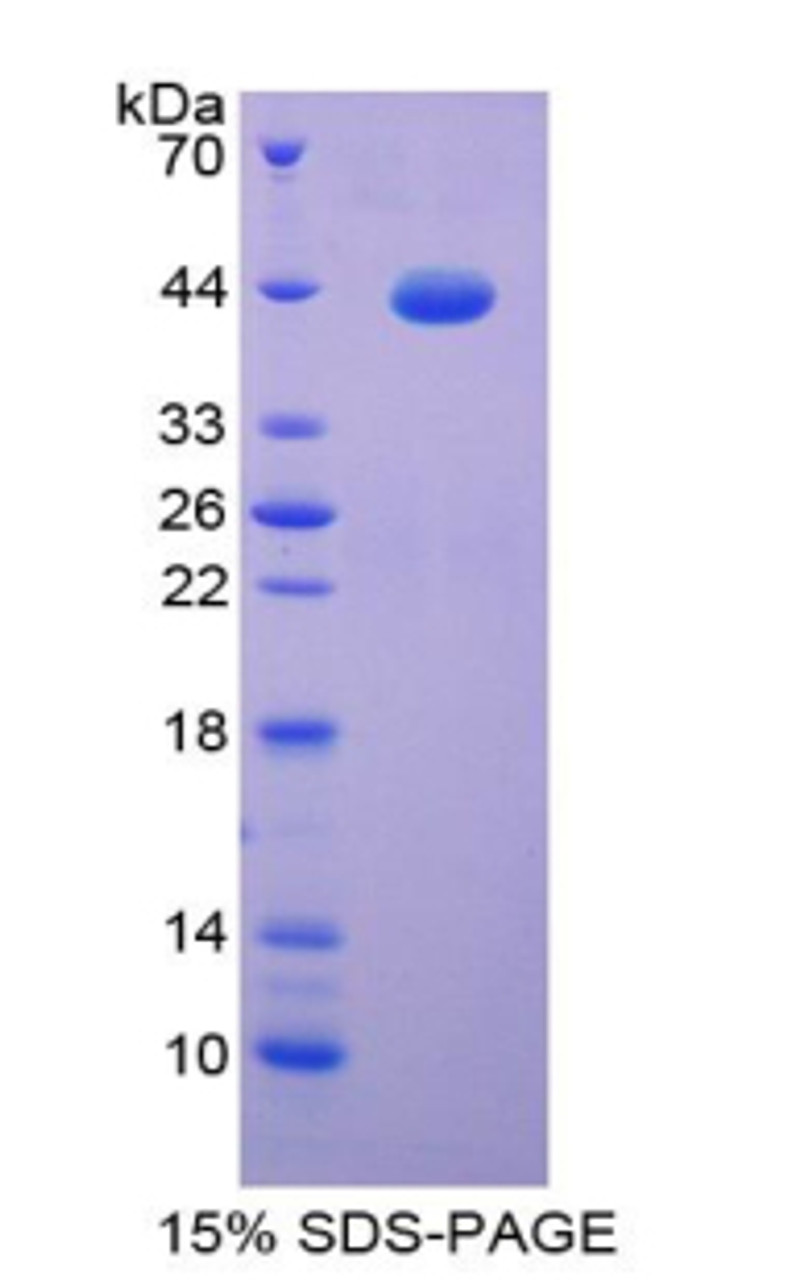 Cattle Recombinant S100 Calcium Binding Protein (S100)