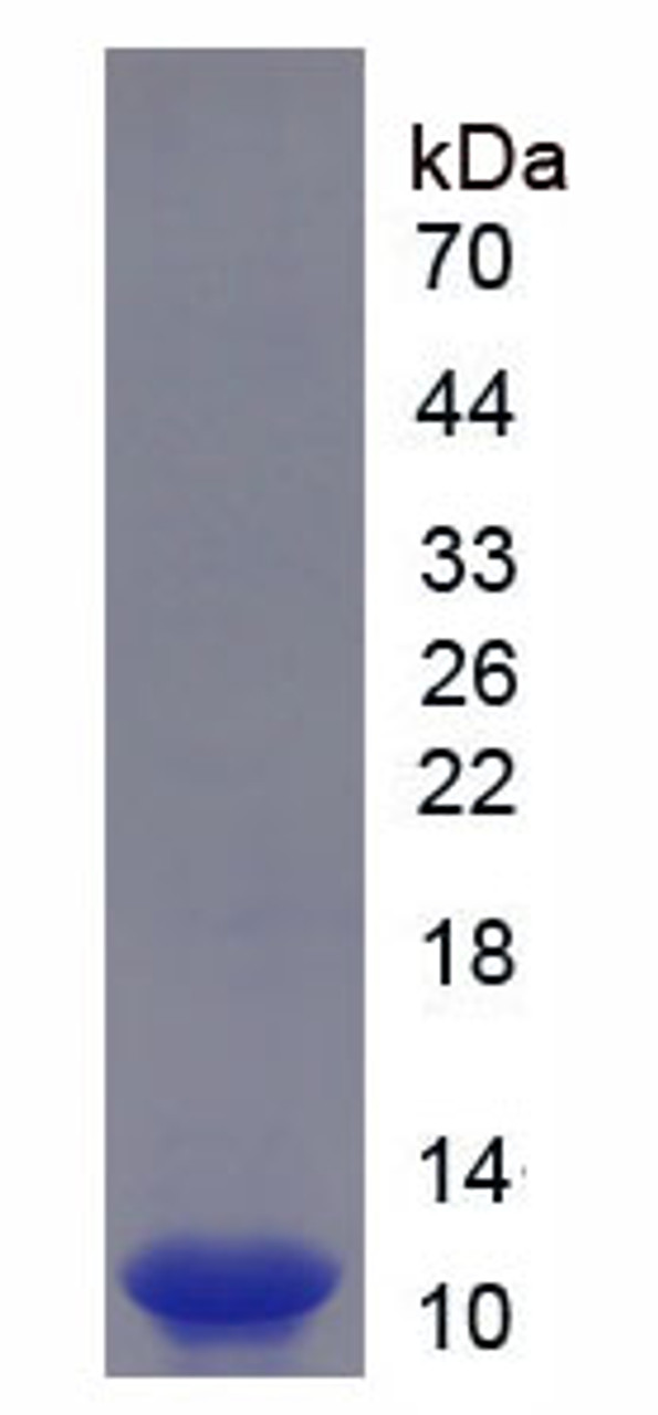 Human Recombinant S100 Calcium Binding Protein (S100)