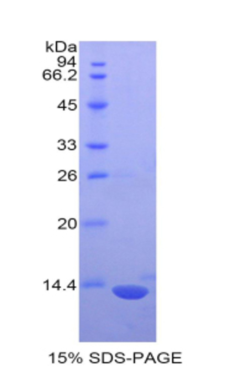 Mouse Recombinant S100 Calcium Binding Protein (S100)