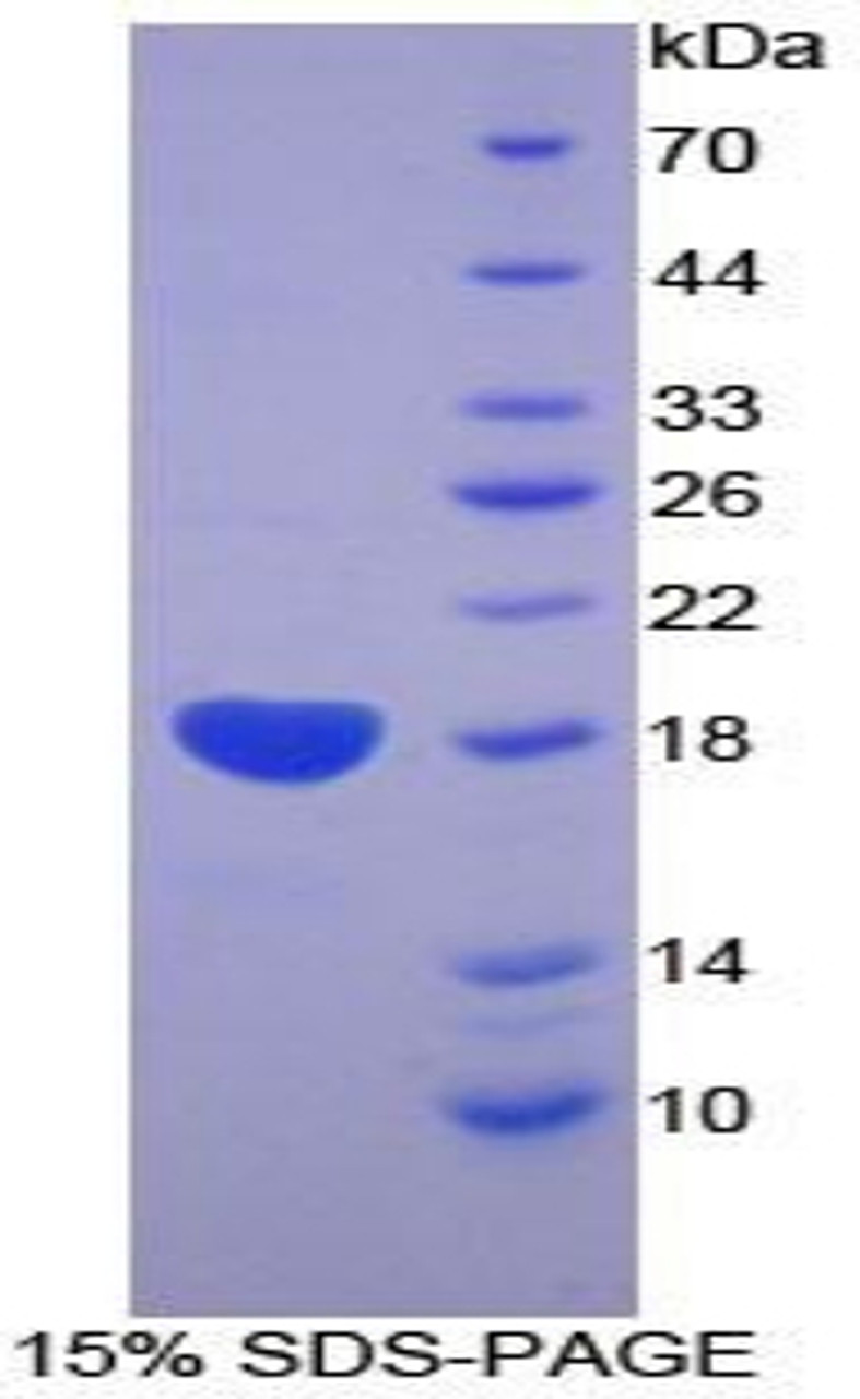 Human Recombinant Bone Morphogenetic Protein Receptor 2 (BMPR2)