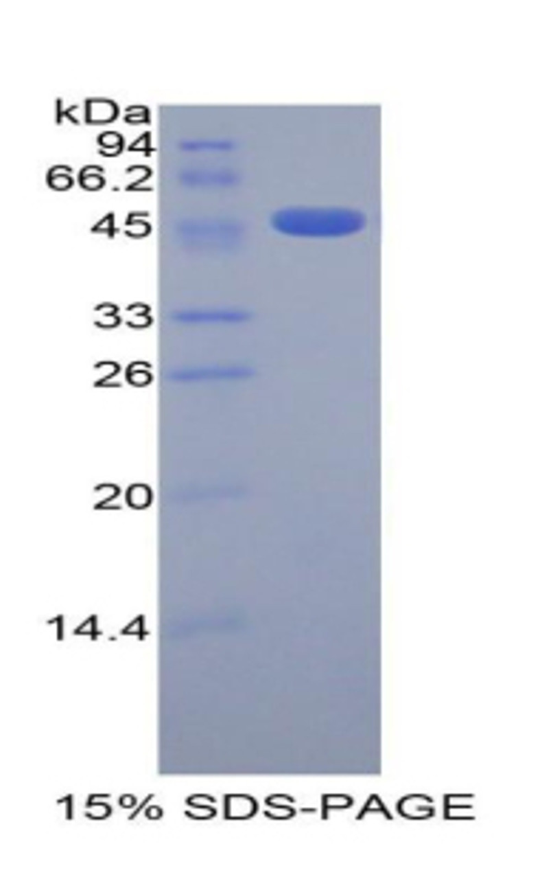 Human Recombinant Erythropoietin Receptor (EPOR)