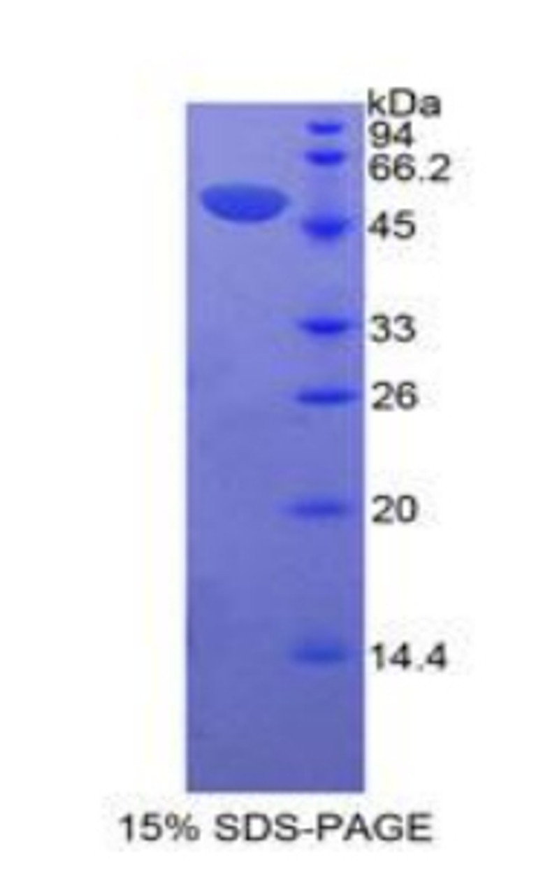 Human Recombinant Erythropoietin Receptor (EPOR)