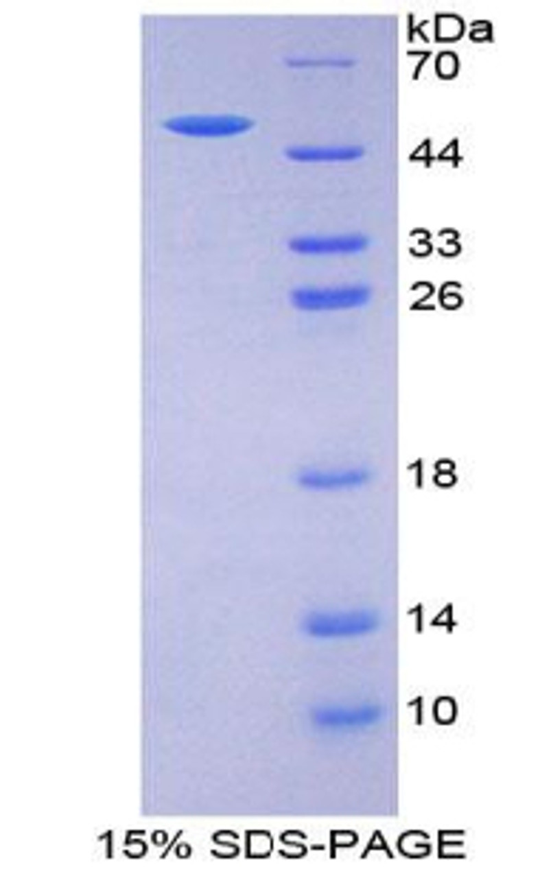 Human Recombinant Erythropoietin (EPO)