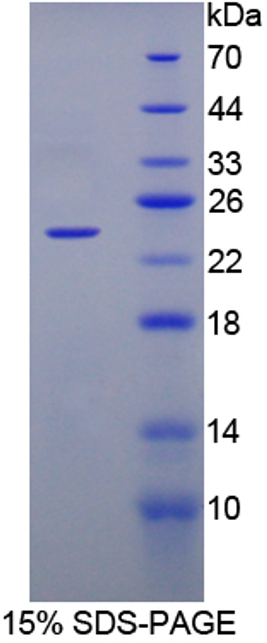 Sheep Recombinant Fibroblast Growth Factor 1, Acidic (FGF1)