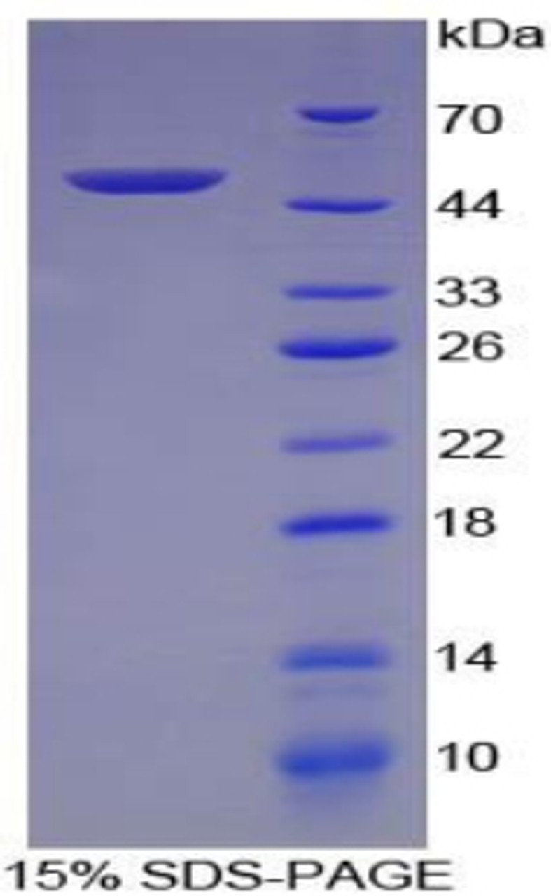 Rat Recombinant Fibroblast Growth Factor 1, Acidic (FGF1)