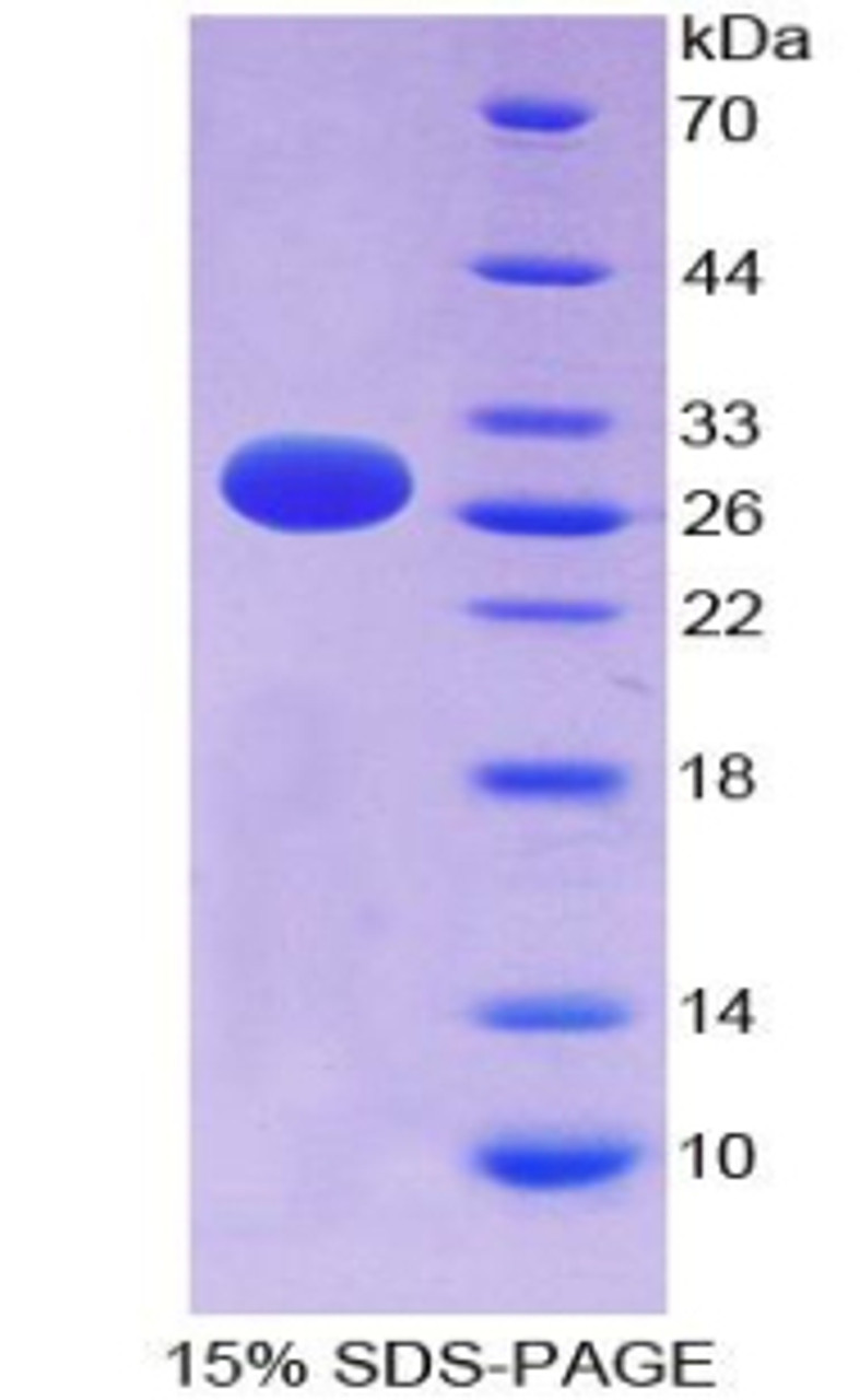 Human Recombinant FMS Like Tyrosine Kinase 3 (Flt3)