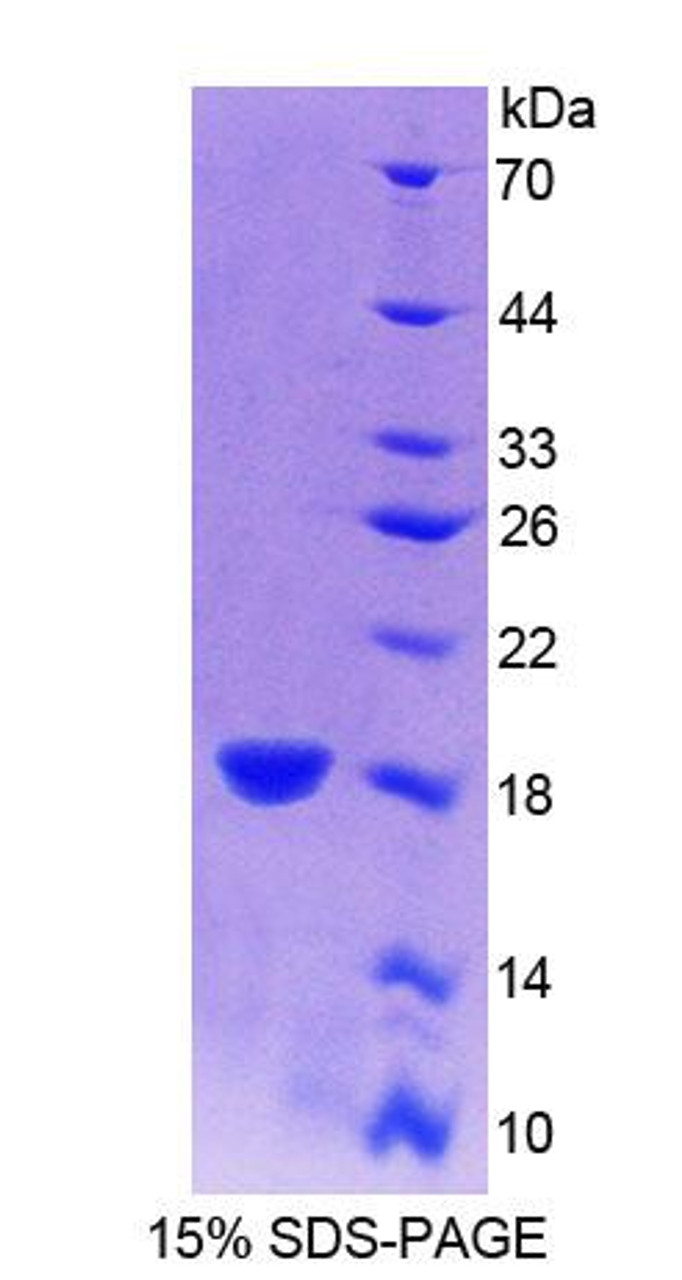 Cattle Recombinant Interferon Gamma (IFNg)