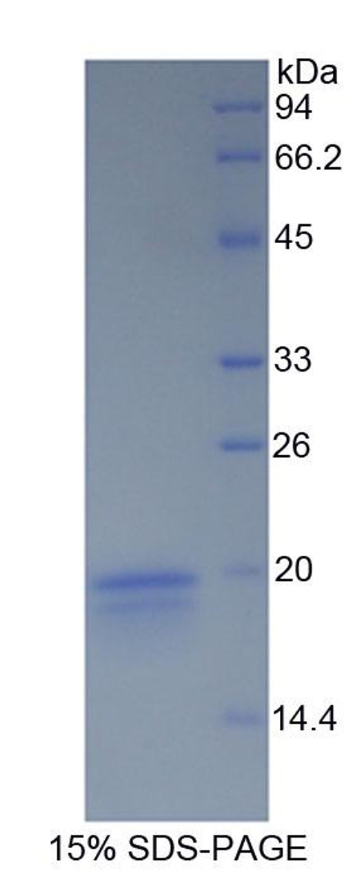 Rabbit Recombinant Interferon Gamma (IFNg)