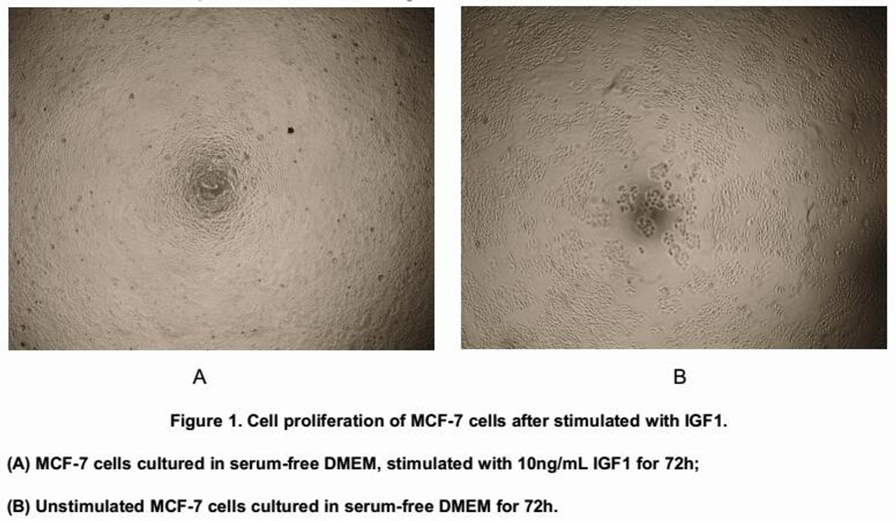 Human Active Insulin Like Growth Factor 1 (IGF1)