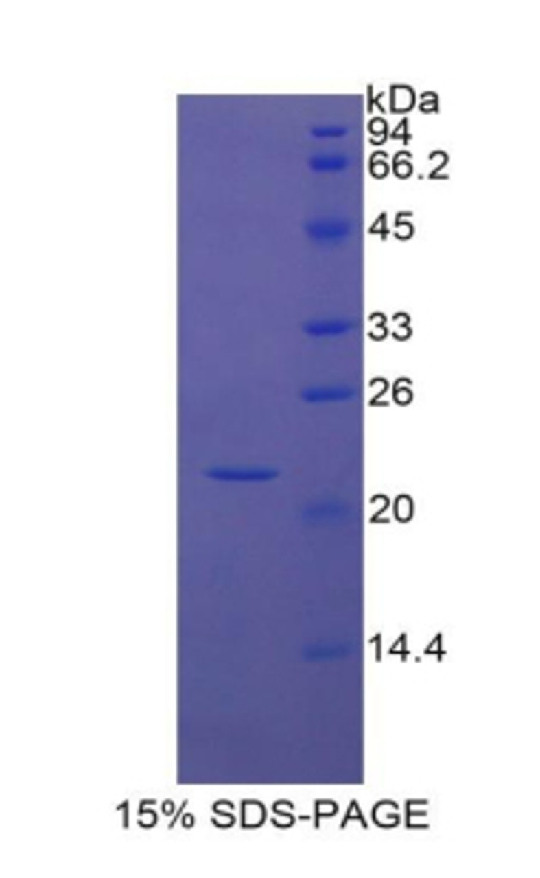 Cattle Recombinant Insulin Like Growth Factor Binding Protein 1 (IGFBP1)