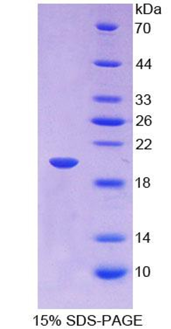 Human Recombinant Insulin Like Growth Factor Binding Protein 2 (IGFBP2)