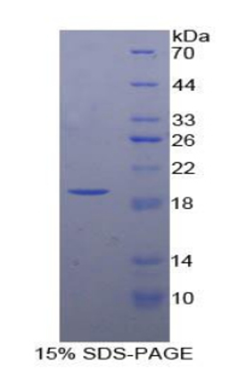 Cattle Recombinant Insulin Like Growth Factor Binding Protein 3 (IGFBP3)