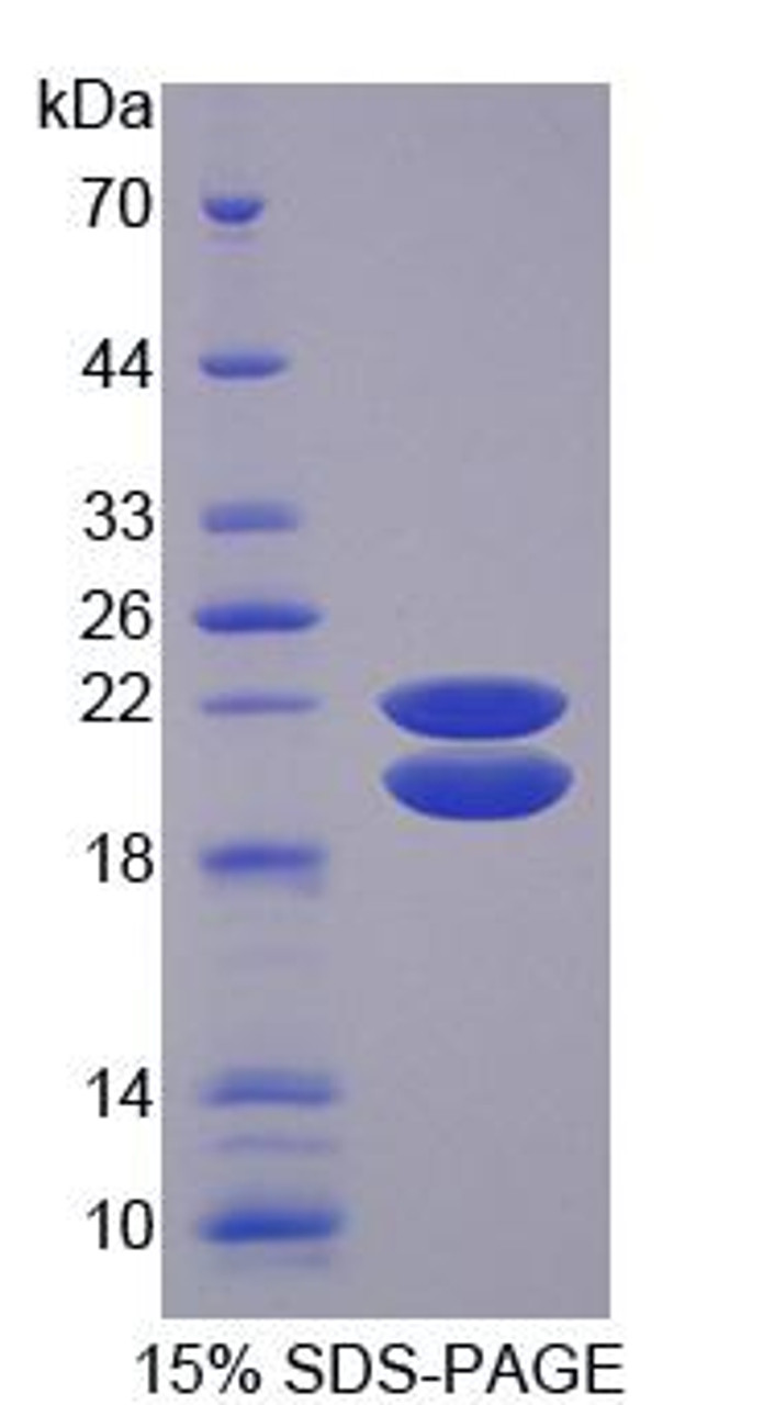 Pig Recombinant Insulin Like Growth Factor Binding Protein 3 (IGFBP3)