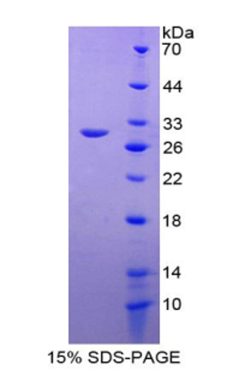 Mouse Recombinant Insulin Like Growth Factor Binding Protein 4 (IGFBP4)