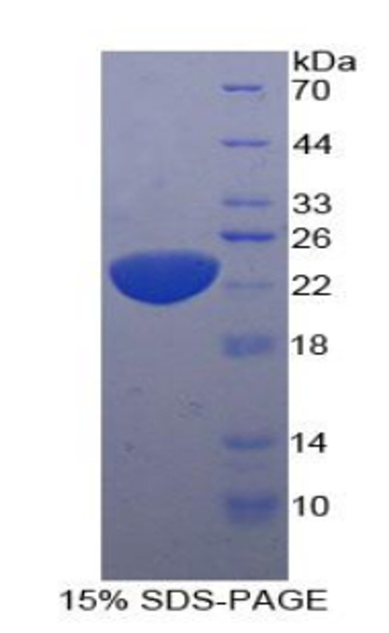 Human Recombinant Interleukin 11 (IL11)