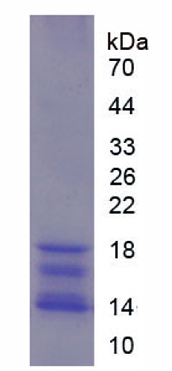 Rat Recombinant Interleukin 15 (IL15)