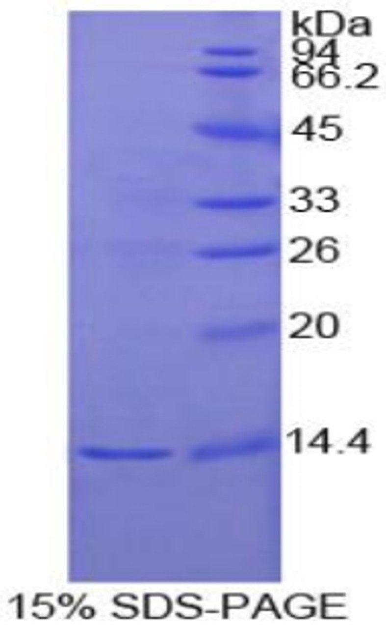 Human Recombinant Interleukin 1 Receptor Type I (IL1R1)