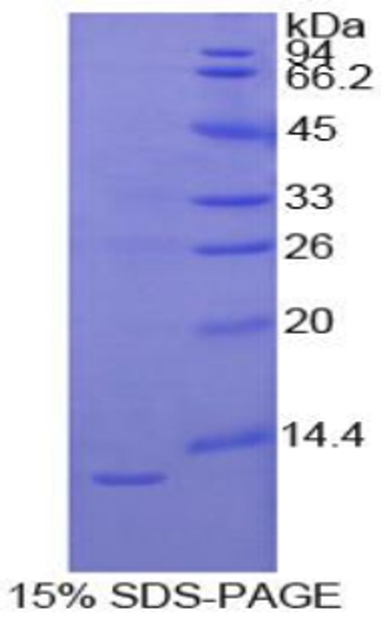 Human Recombinant Interleukin 1 Receptor Type I (IL1R1)