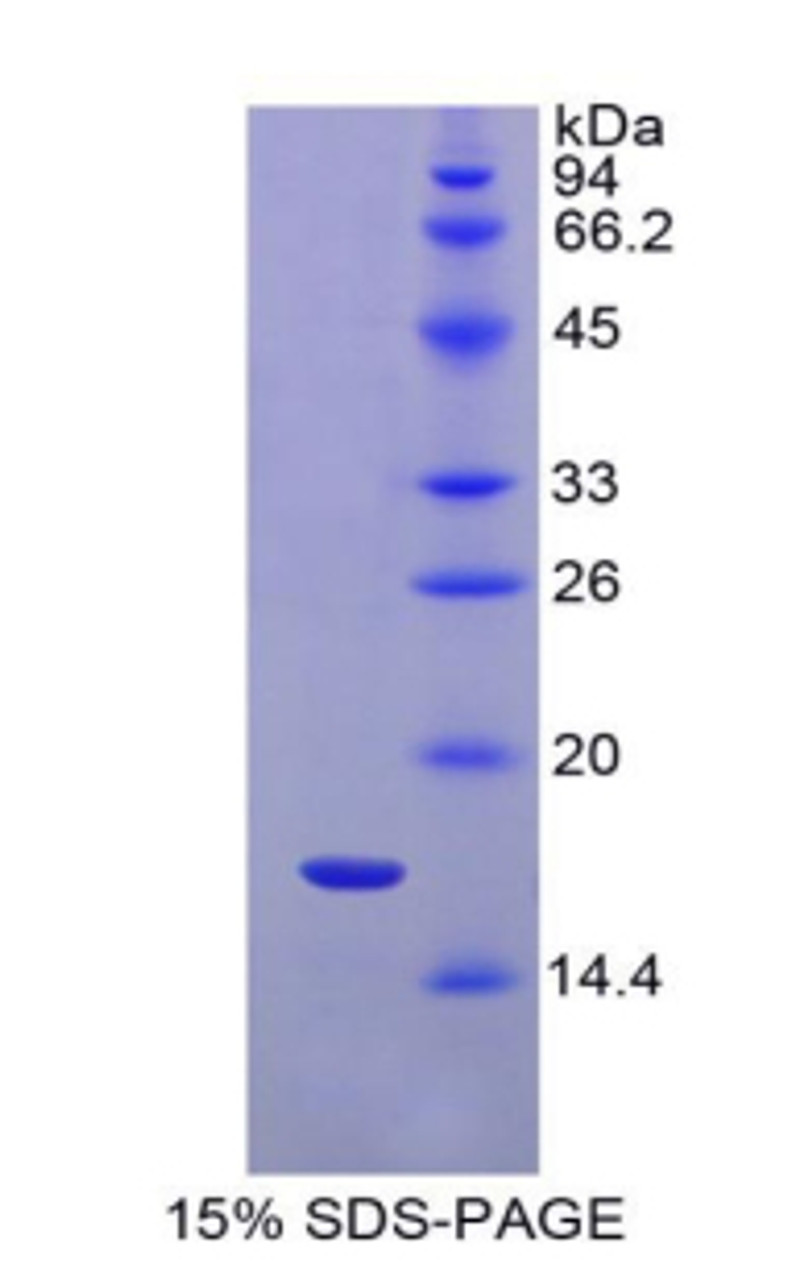 Rat Recombinant Interleukin 1 Receptor Type I (IL1R1)