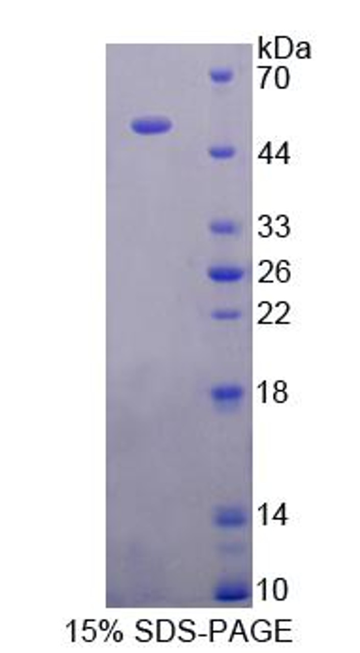 Rat Recombinant Glial Fibrillary Acidic Protein (GFAP)