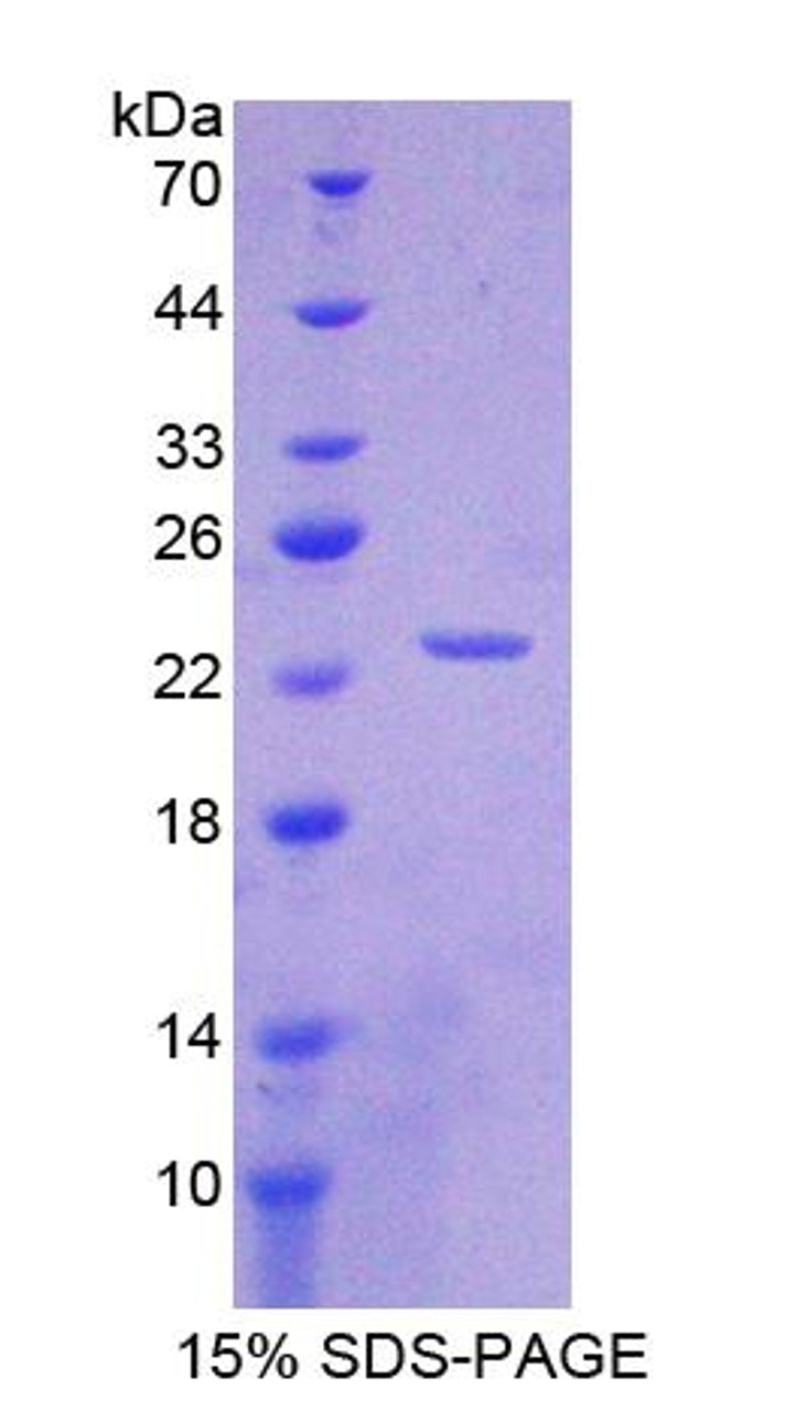 Mouse Recombinant Interleukin 1 Alpha (IL1a)