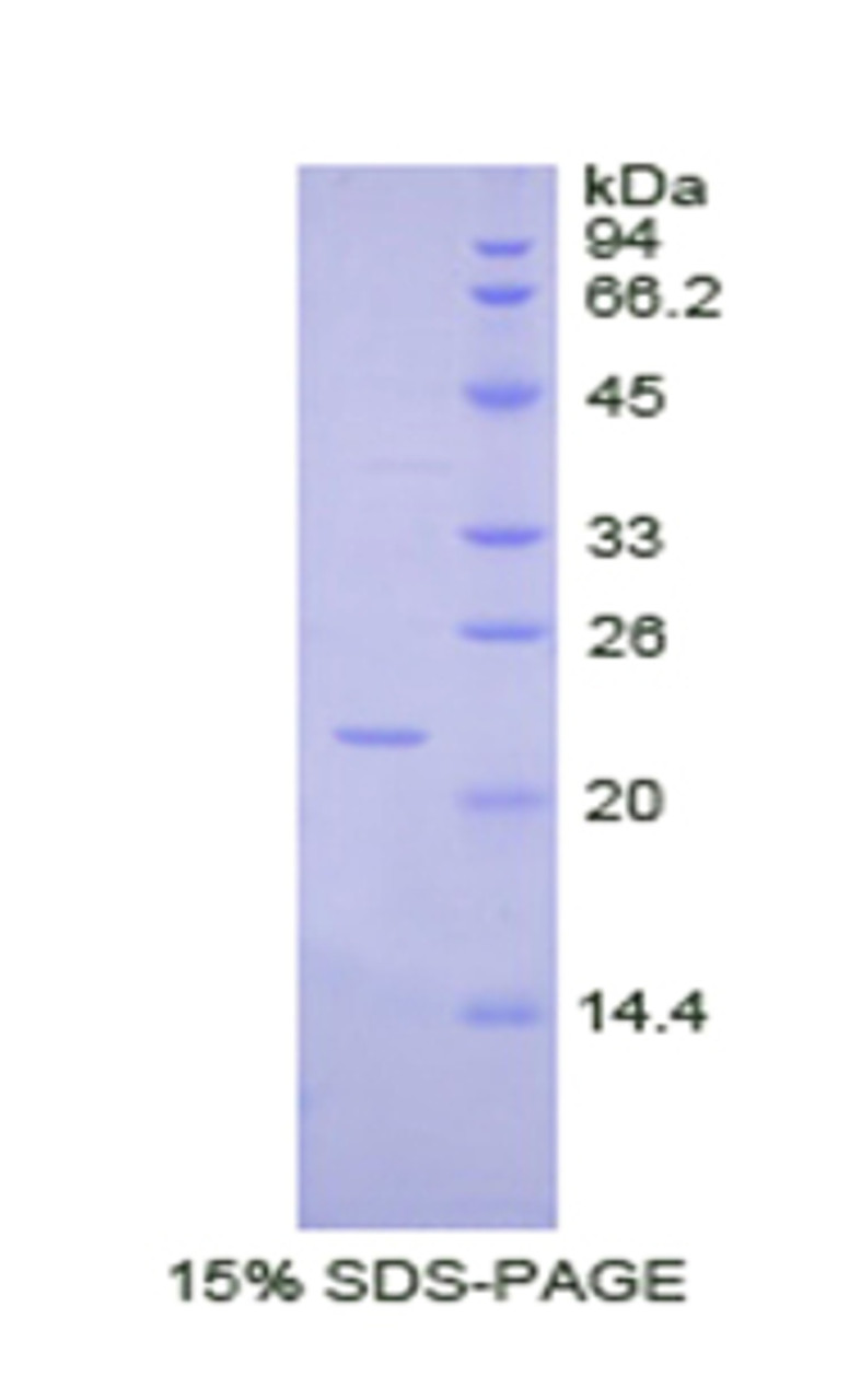 Pig Recombinant Interleukin 1 Alpha (IL1a)