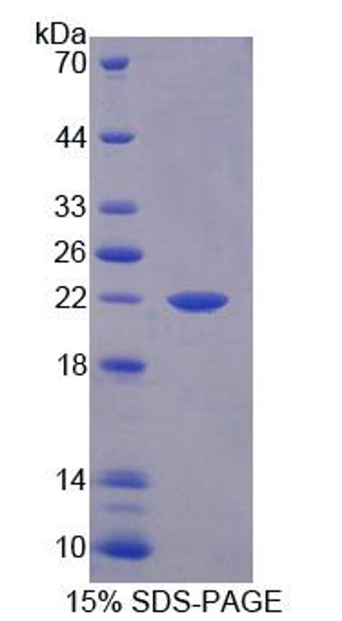 Rat Recombinant Interleukin 1 Alpha (IL1a)