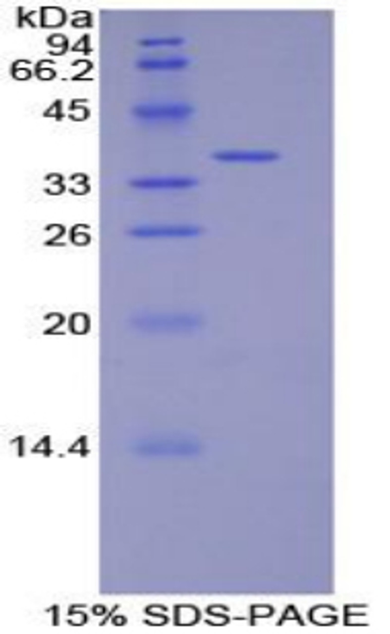 Rat Recombinant Defensin Beta 2 (DEFb2)