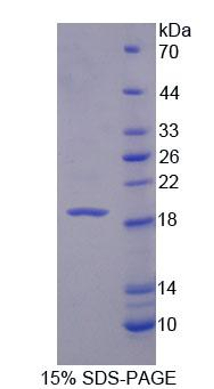 Mouse Recombinant Interleukin 3 (IL3)