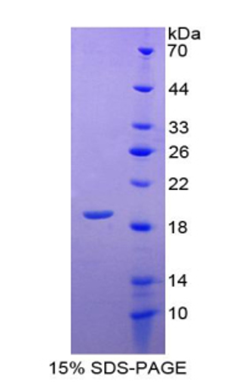 Cattle Recombinant Leptin (LEP)