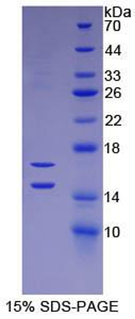 Human Recombinant Monocyte Chemotactic Protein 1 (MCP1)