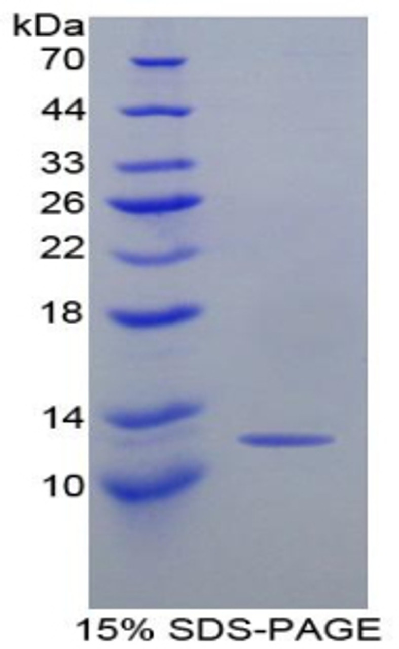 Mouse Recombinant Monocyte Chemotactic Protein 1 (MCP1)