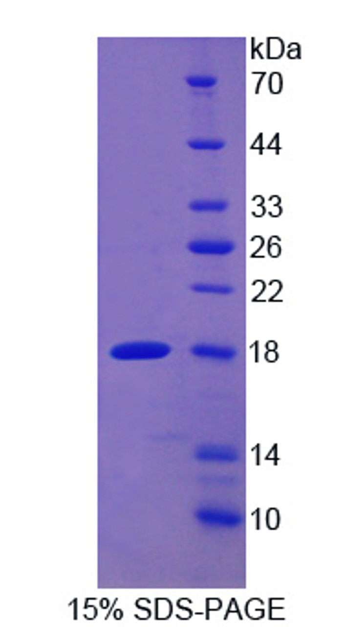 Rabbit Recombinant Monocyte Chemotactic Protein 1 (MCP1)