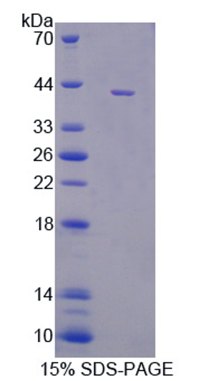 Pig Recombinant Monocyte Chemotactic Protein 2 (MCP2)
