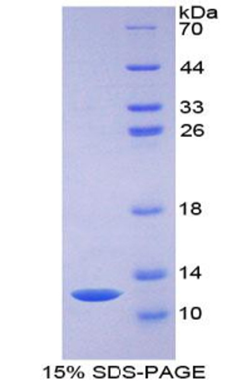 Rat Recombinant Monocyte Chemotactic Protein 3 (MCP3)