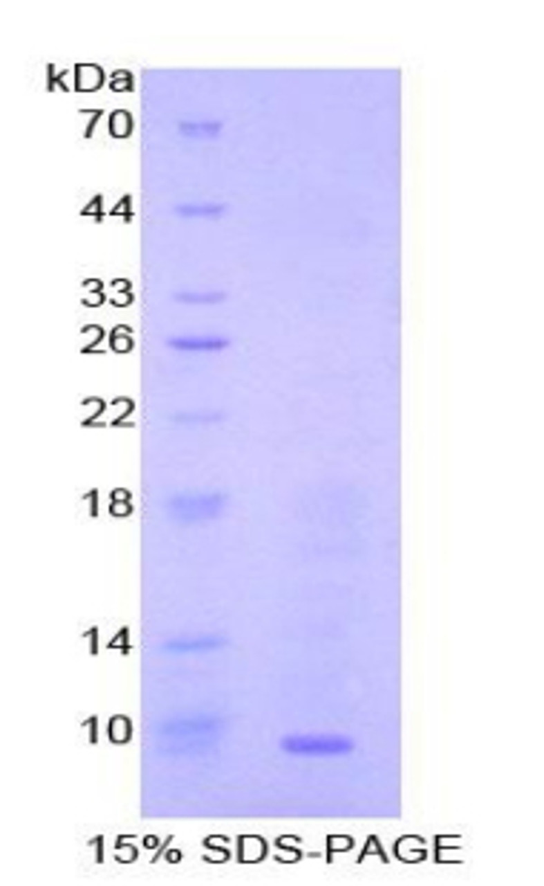 Mouse Recombinant Macrophage Derived Chemokine (MDC)