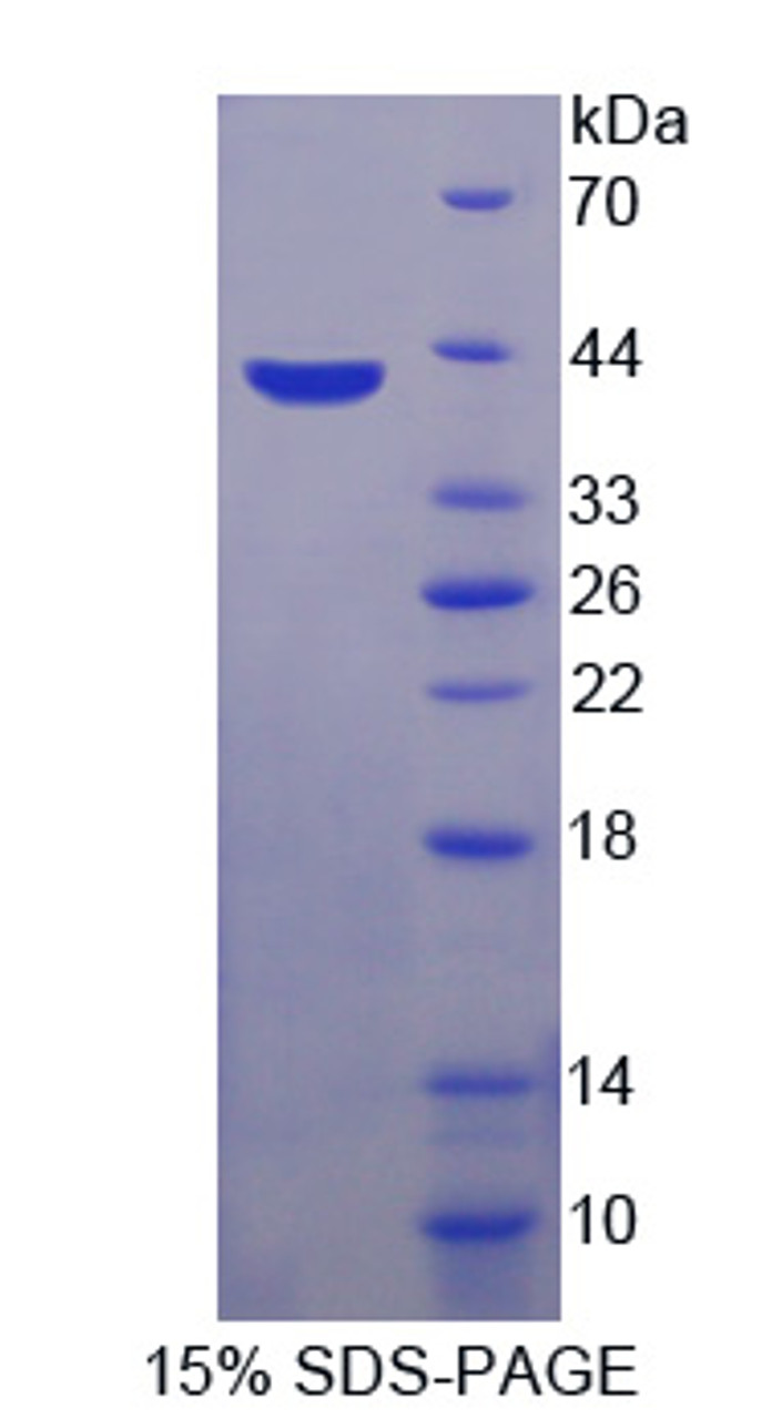 Rabbit Recombinant Macrophage Inflammatory Protein 1 Beta (MIP1b)